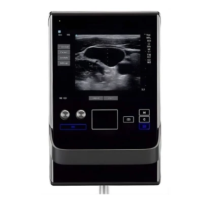 Fujifilm Sonosite SII Ultrasound Machine